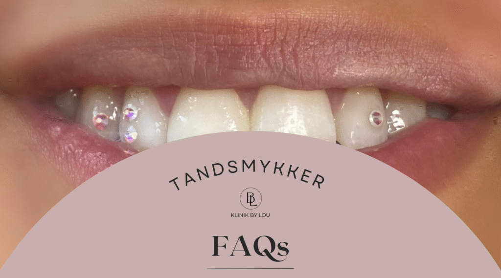 FAQ Tandsmykker